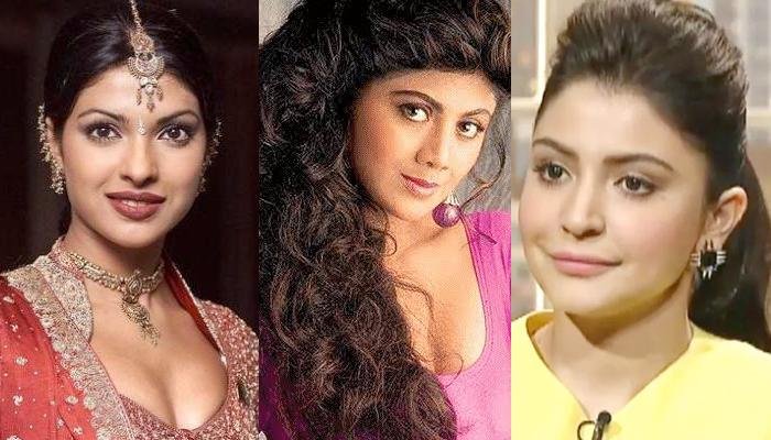 B-Town Divas Who Are Proud Of Their Plastic Surgeries And Fillers, Priyanka Chopra To Anushka Sharma