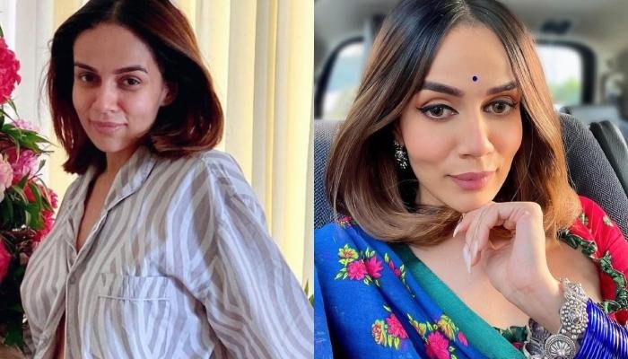 Komal Pandey Accepts Undergoing Lip Fillers And Botox At A Young Age: